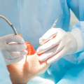 How Can A Restoration Dentist In San Antonio Address Tooth Loss Through Oral Surgery?
