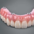 Beyond The Surface: Unveiling The Role Of Oral Surgery In Dental Implant Procedures in Austin