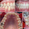 Oral Surgery For Craniomandibular Dysfunction: What Basel Residents Need To Know