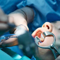 Understanding The Role Of Periodontics In Successful Oral Surgeries In San Antonio