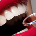 What to Expect During an Oral Surgery Procedure