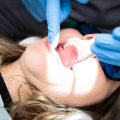 The Benefits Of Oral Surgery For Wisdom Teeth Extraction In Austin