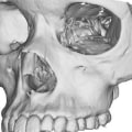 What Diseases Do Oral Surgeons Treat?