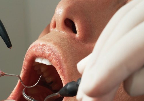 Is Oral Surgery Permanent? A Comprehensive Guide