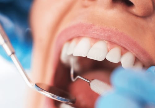 Is Oral Surgery Painful? Expert Advice on What to Expect