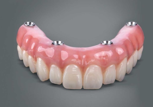 Beyond The Surface: Unveiling The Role Of Oral Surgery In Dental Implant Procedures in Austin