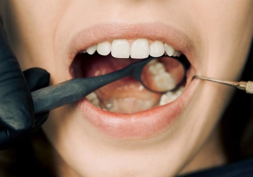 How to Reduce Swelling After Oral Surgery Naturally