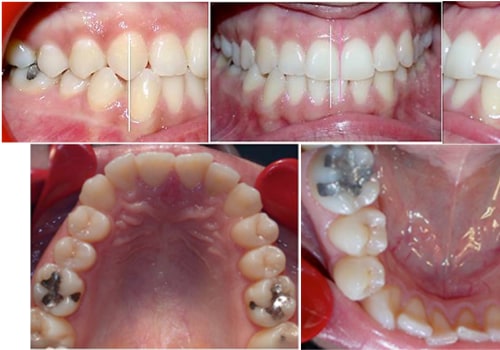 Oral Surgery For Craniomandibular Dysfunction: What Basel Residents Need To Know