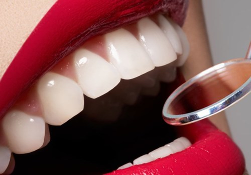 What to Expect During an Oral Surgery Procedure
