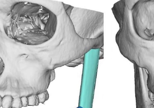 What Diseases Do Oral Surgeons Treat?
